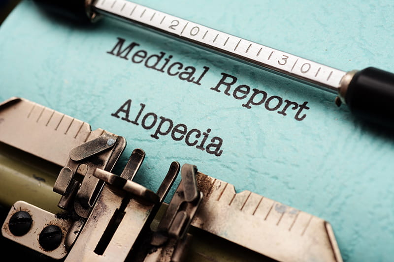 Alopecia