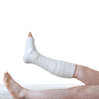 Fracture_Leg