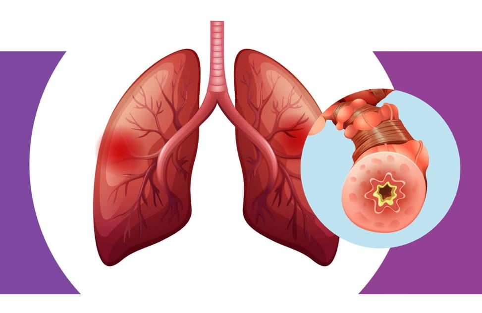 lungs