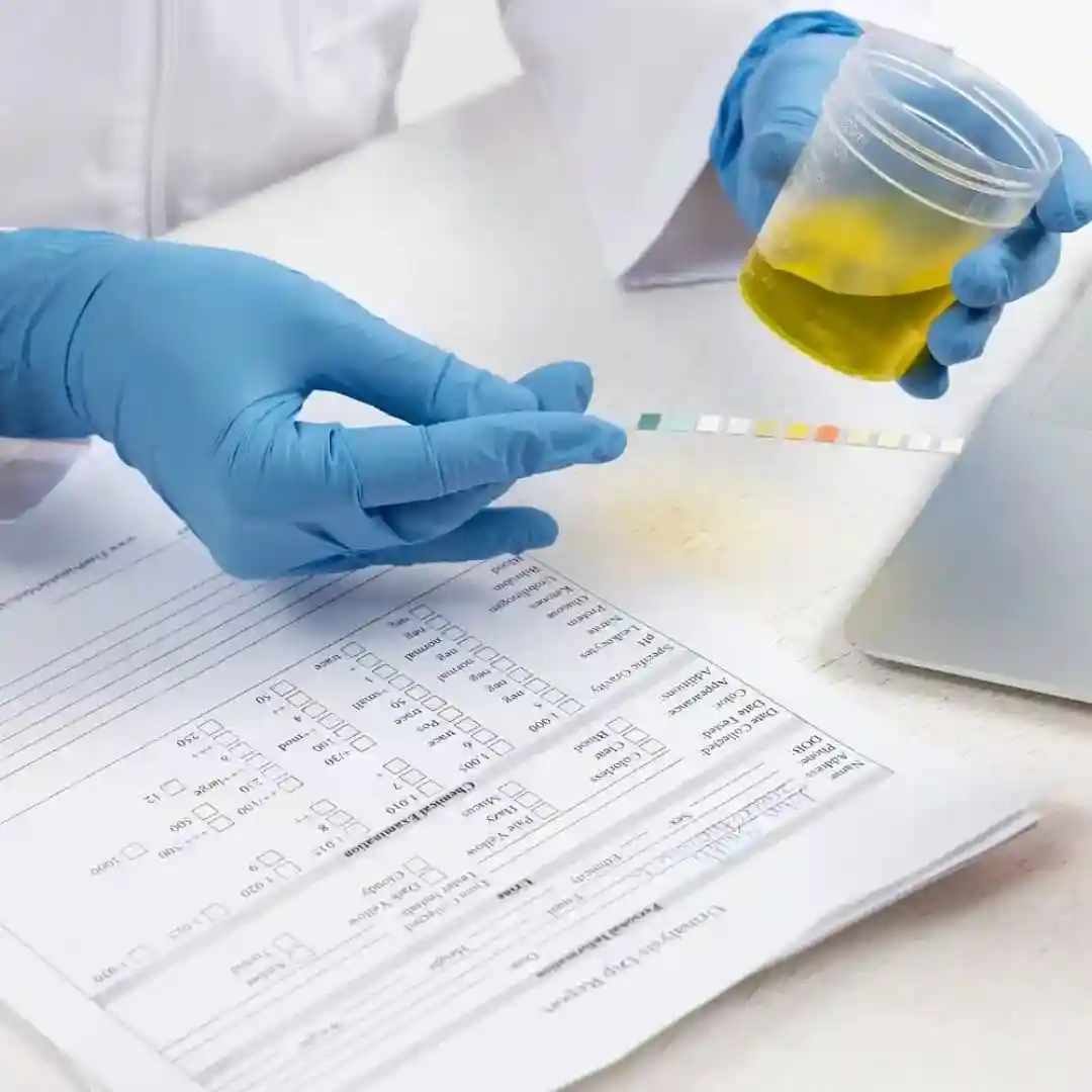 Urine Examination